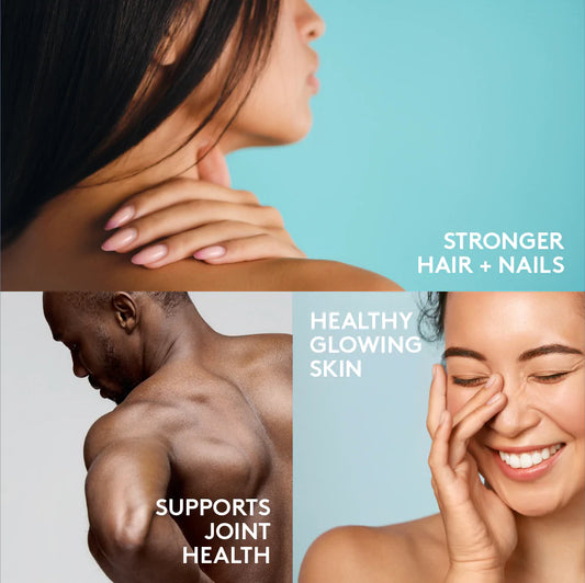 Joint pain healthy skin glow and strong hair and nails collagen Sproos Shaughnessy Pharmacy Vancouver